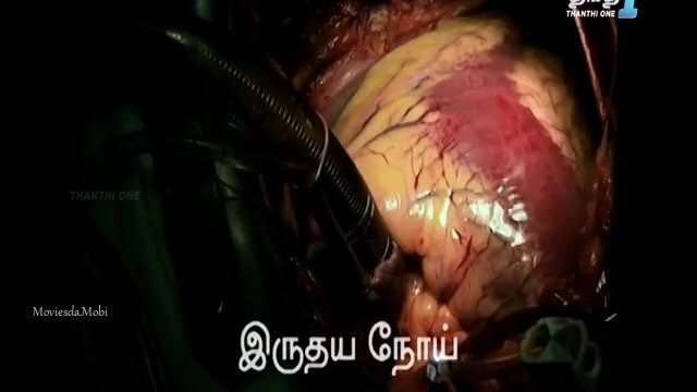 Case 30 2024 HD.mp4
