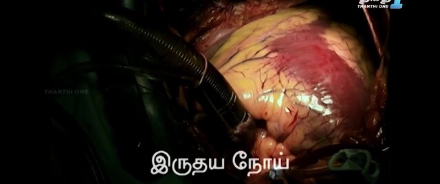 Moviesda.Mobi - Case 30 2024 Original 720p HD.mp4