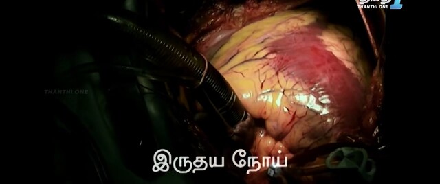 Moviesda.Mobi - Marichi 2024 Original 720p HD (800MB).mp4