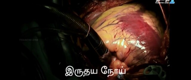 Moviesda.Mobi - Idaivelai 2024 Original 720p HD.mp4