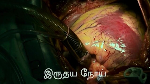 Moviesda.Mobi - Ingu Mirugangal Vaazhum Idam 2024 Original 720p HD.mp4